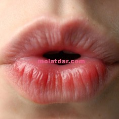 القبلة تساعد على علاج فقدان الشهية