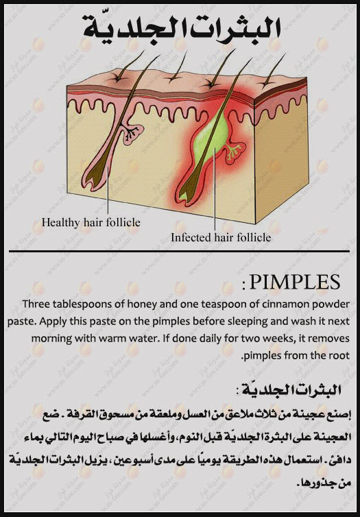 القرفة والعسل 17