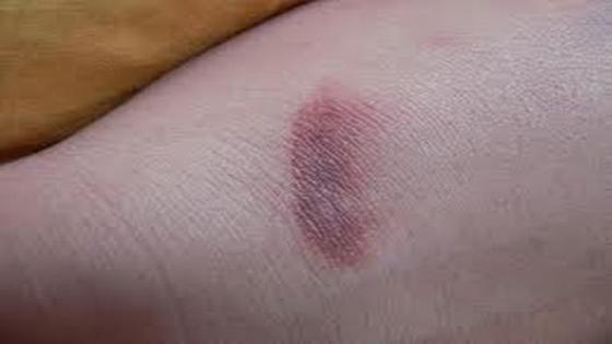 تحرقتي و بغيتي دغيا يبرد ليك الحريق ..دخلي تعرفي كيفاش