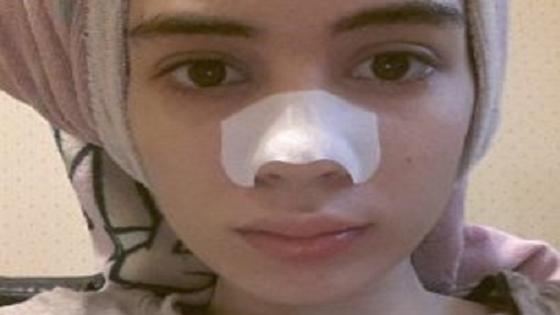 وصفة فعالة لإزالة الرؤوس السوداء جربيها وشوفي براسك النتيجة