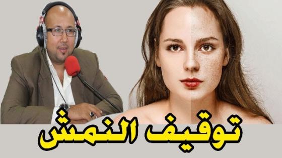 الدكتور عماد ميزاب يقدم وصفة المريمية لتوقيف ظهور النمش في الوجه