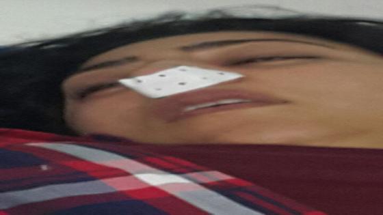 بالصور..اعتداء على الممثلة دنيا بوطازوت