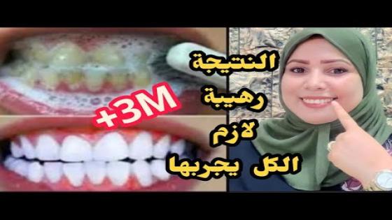تبيض الأسنان في دقائق قسما بالله تزيل الإصفرار وتسقط الجير ووصفة لعلاج إلتهاب اللثة نتائح مدهشة