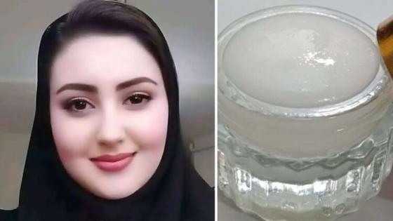 خلطة خارقة وسحرية للقضاء على الكلف مهما كان داكنا