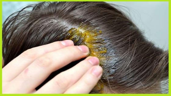 خلطة لتكثيف الشعر مجربه