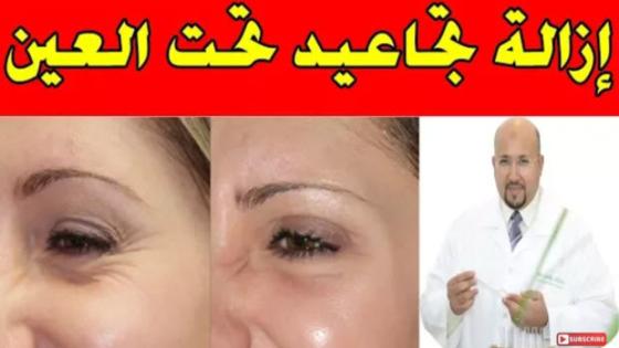 لي بداوها التجاعيد تحت العين تجرب هاد الكريم ديال عماد ميزاب دقة بطلة