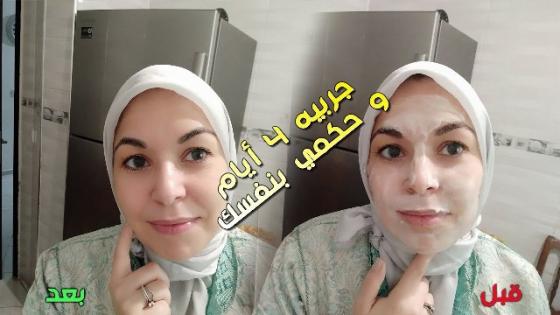 ماسك ماء البطاطس مع النشا لتبييض البشرة وإزالة حروق الشمس